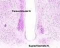 Cross-section of the monkey hypothalamus displays two of the major hypothalamic nuclei on either side of the fluid-filled third ventricle.