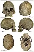 Burial 26 - Cranium