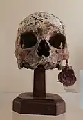 Alleged skull of Athalaric at the Anatomical Wax Museum of Bologna, now believed to have belonged to a middle-aged, 16th-17th century man.[4]