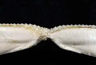 Lower teeth