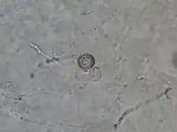 Oospore of Pythium sulcatum