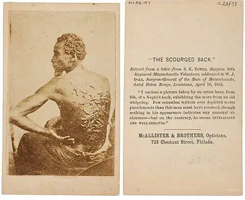 Third and final photo of Peter, taken sometime later; note growth of facial and head hair and somewhat more confrontational pose; this was the version shared with Harper's Weekly.