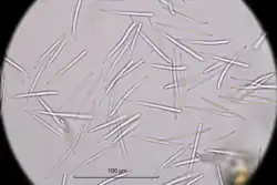Conidia of a Septoria found on Hyacinthoides non-scripta.