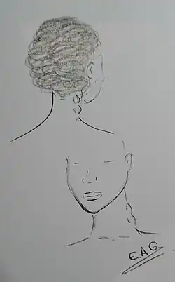 A sketch of two women suffering with lumps on the sides of their necks