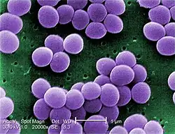 alt=Scanning electron micrograph of "S. aureus"; color added
