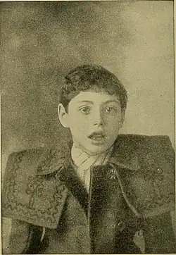 1911 photograph of mouth breathing child