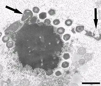 Electron micrograph of a virus factory in an amoeba co-infected with Zamilon virophage (small particles) and Mont1. Arrows show abnormal Mont1 particles (scale bar: 0.1 μm)