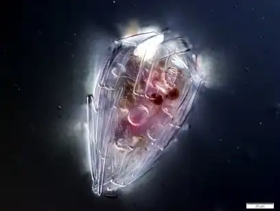 Xenogenic testate amoeba covered in diatoms (from Penard's Amoeba Collection)